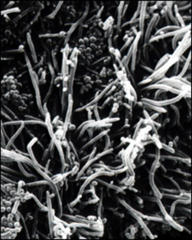 Leeuwenhoek observa bacteris de la seva boca