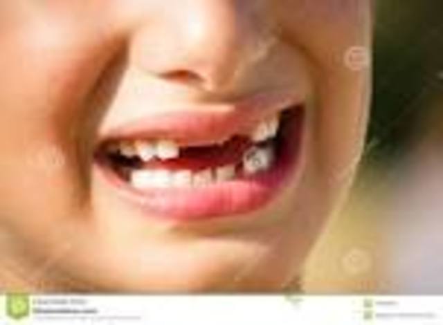 Loosing my first tooth