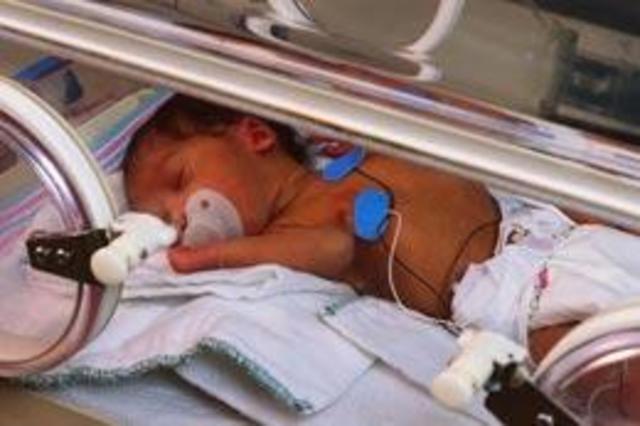 Donya was in an incubator for a few weeks