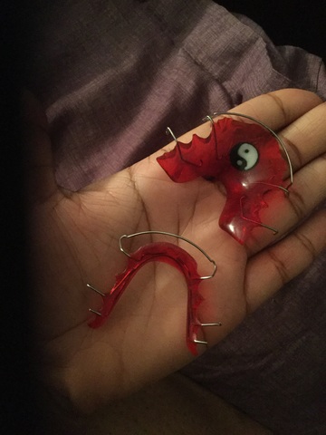 The effects of braces