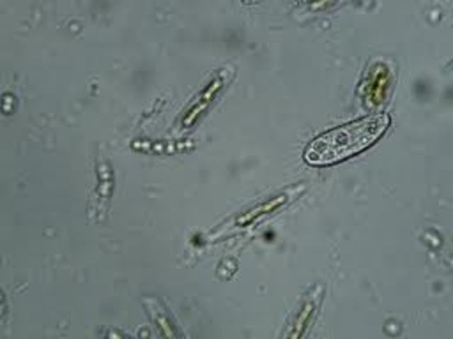 Observacio de protozous de Leeuwenhoek