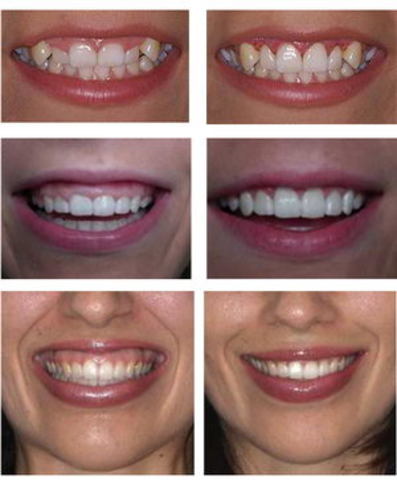 Dental tourism in Greece