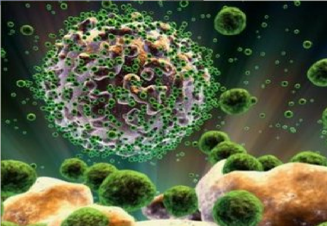 Síndrome de Inmunodeficiencia Humana