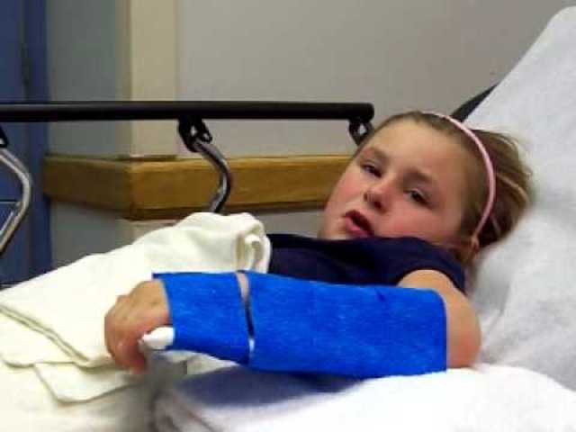 when i broke my arm