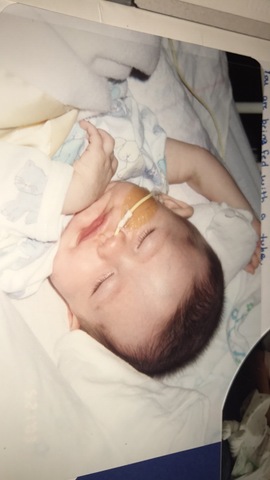 Feeding Tube Incident