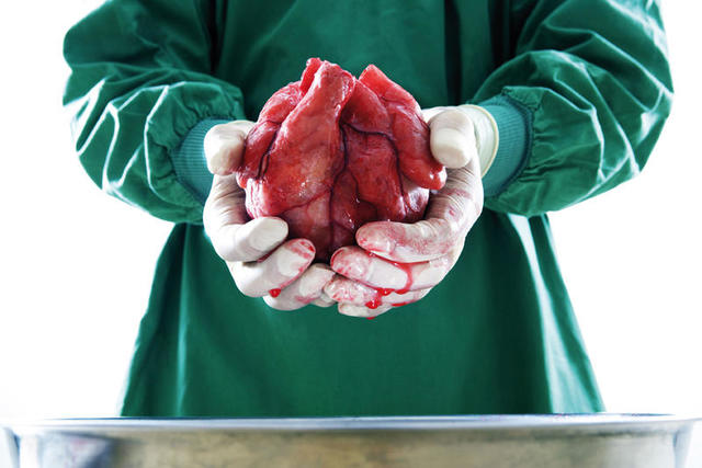1º Human Heart Transplantation