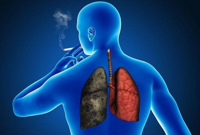 CIGARROS Y EL CÁNCER PULMONAR