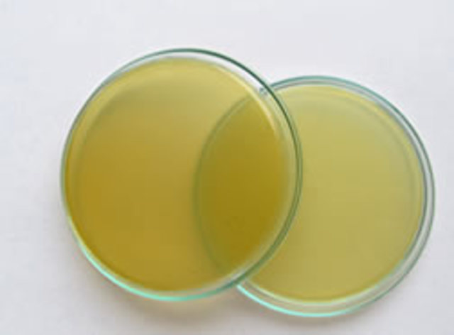 Agar - Agar.Walther y Angelina Fannie Hasse