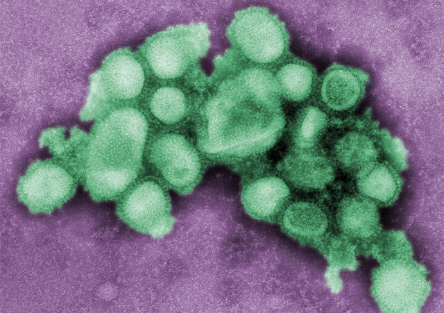 Pandemia Gripe de 1918