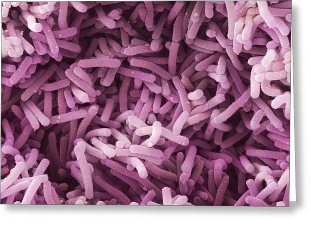 Descubrimiento Lactobacillus casei shirota.