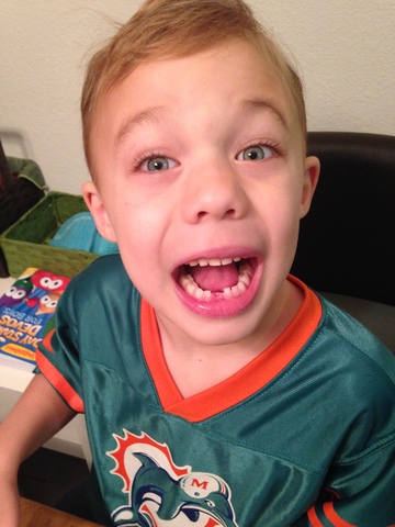 Lost my first tooth.