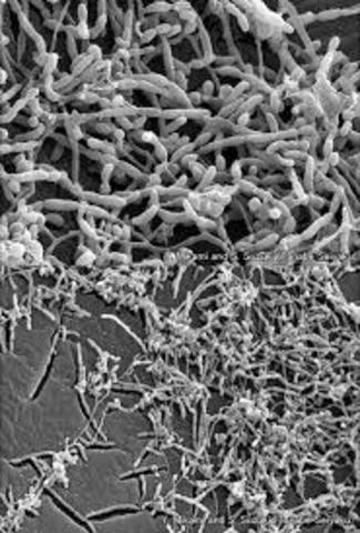 Secuenciacion del genoma de "Saccharopolyspora erythaea