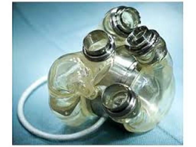 The first successful artificial heart implantation into a human.