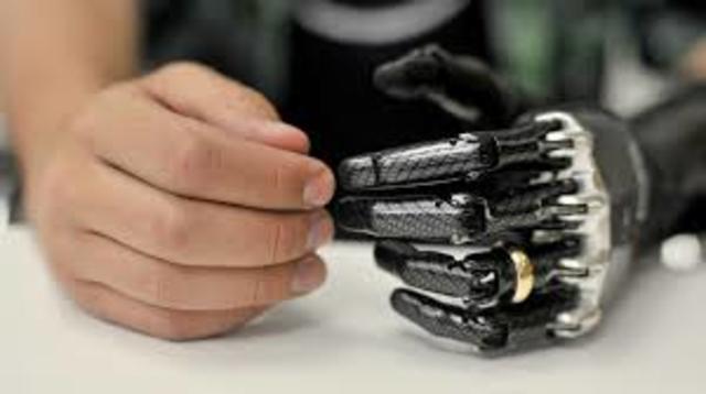 Internal organs are replaced by cybernetic devices