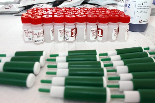 Incertidumbre entre la comunidad LGBTI por falsos negativos en pruebas rápidas