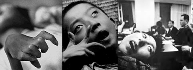 Accidente en Minamata Japón