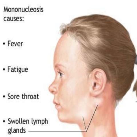The day I got tested for mono and realized I had it.
