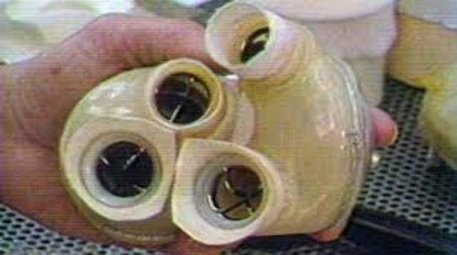The first artificial heart