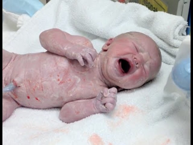 End of Period of Fetus