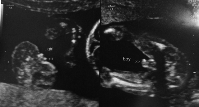 week of sex detection