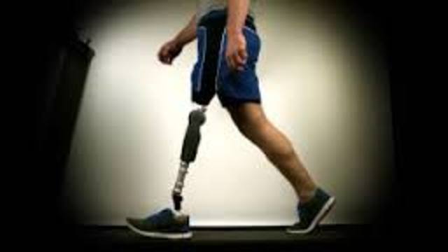 Adaptive Artificial Knee