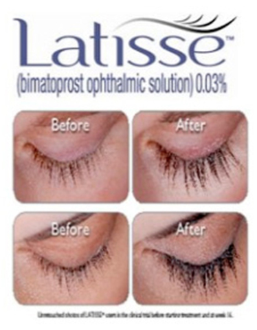 First Lash Length Enhancement