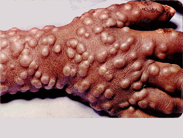 Disease and Indigenous Population Loss