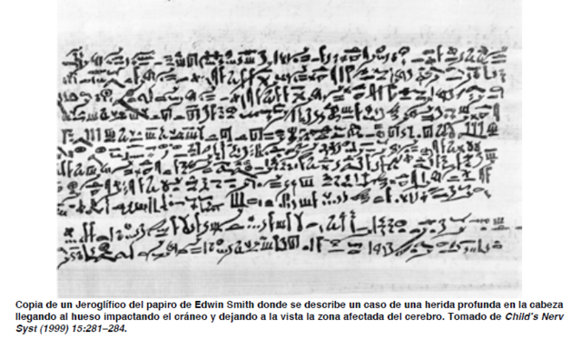 Papiros de Edwin Smith