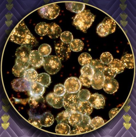 Nanocápsulas de oro.