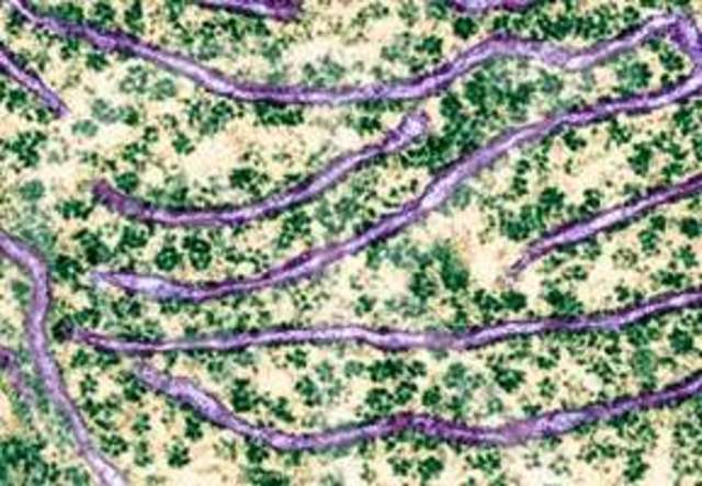Descobriment del reticle endoplasmàtic