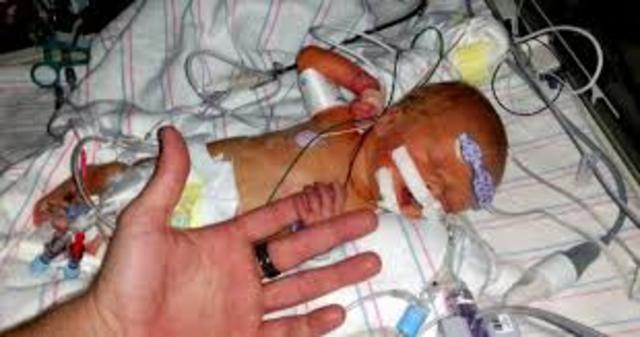 Heart transplant on 12-day-year-old baby girl