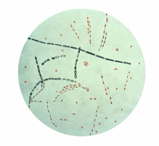 Bacillus anthracis felfedezése
