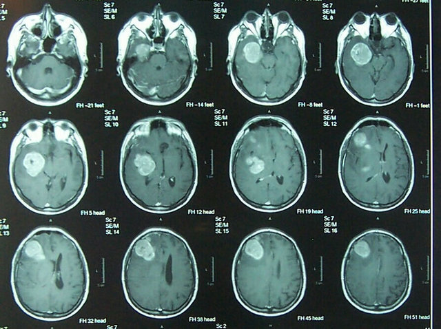Se fortalece la investigación sobre imágenes funcionales