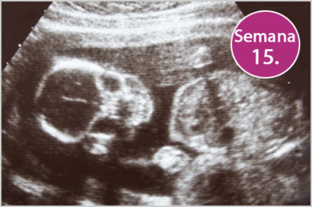 Semana 15