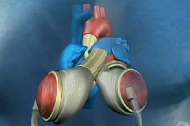 artificial heart and liver invented