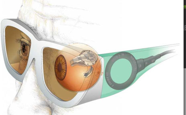 retinal impants are invented