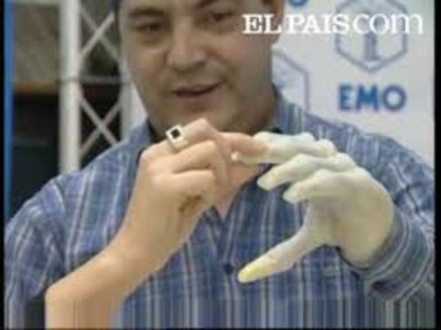 Primer implante de mano
