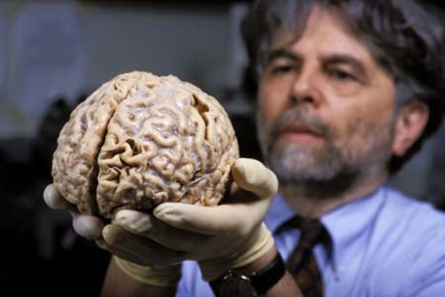 Surgimiento del primer cerebro