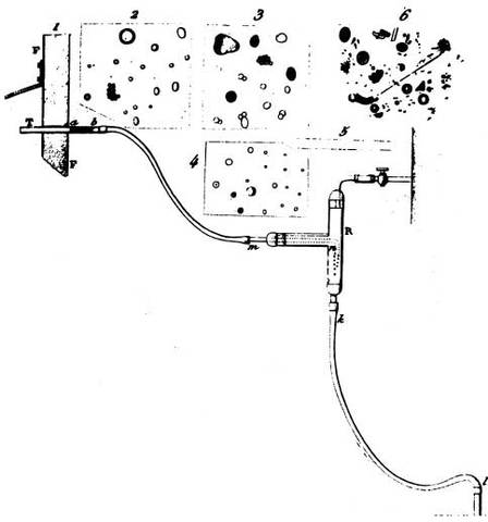 Louis Pasteur Preceding the 'Swan-Necked Flask'