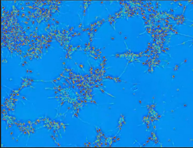 Primera agrupación de neuronas