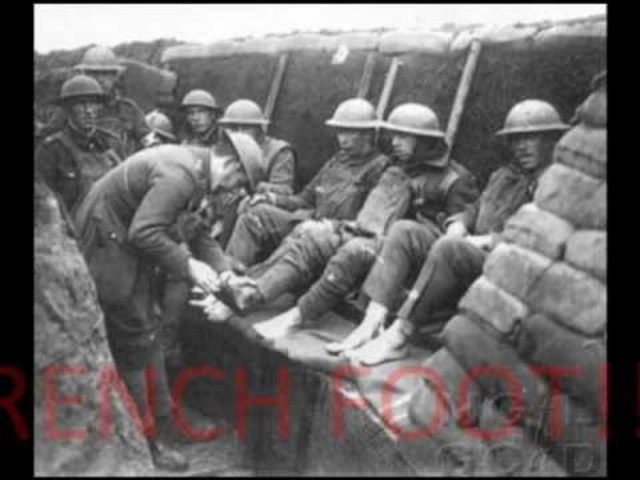 shell shock trench foot