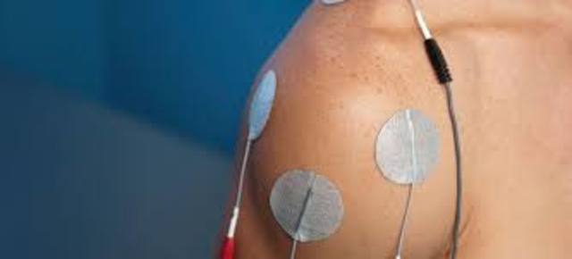 Surge la electroterapia