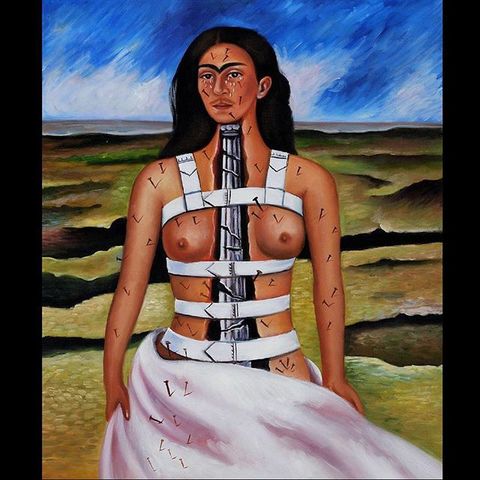 ACCIDENTE E INICIO DE SU ARTE