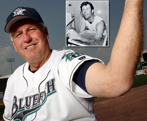 Tommy john undergoes surgery that becomes named after him