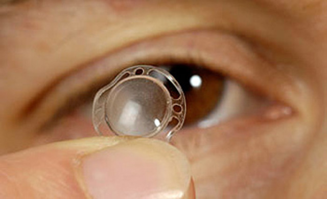 IMPLANTES DE RETINA