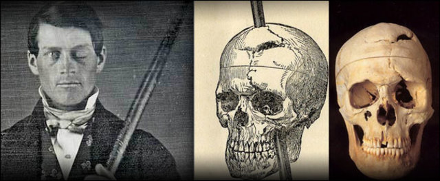 Phineas Gage