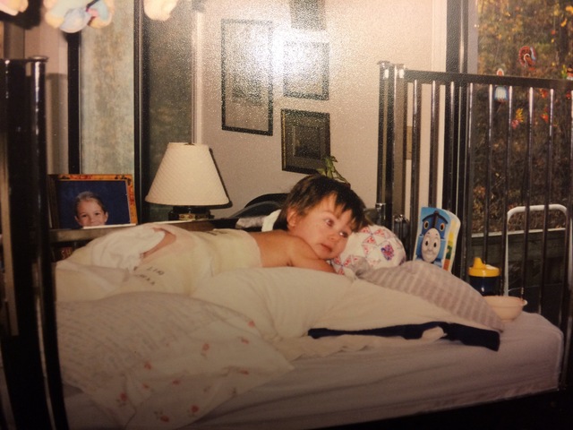 Me rompí la pierna.