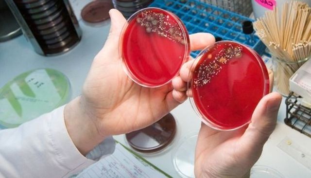 Microbiología en México