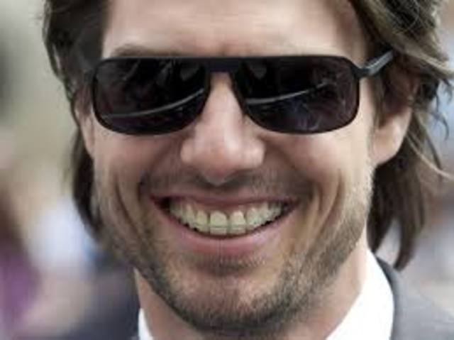 Ellos me puseron frenillos