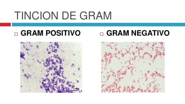 Desarrollo de la "Tinción de Gram"